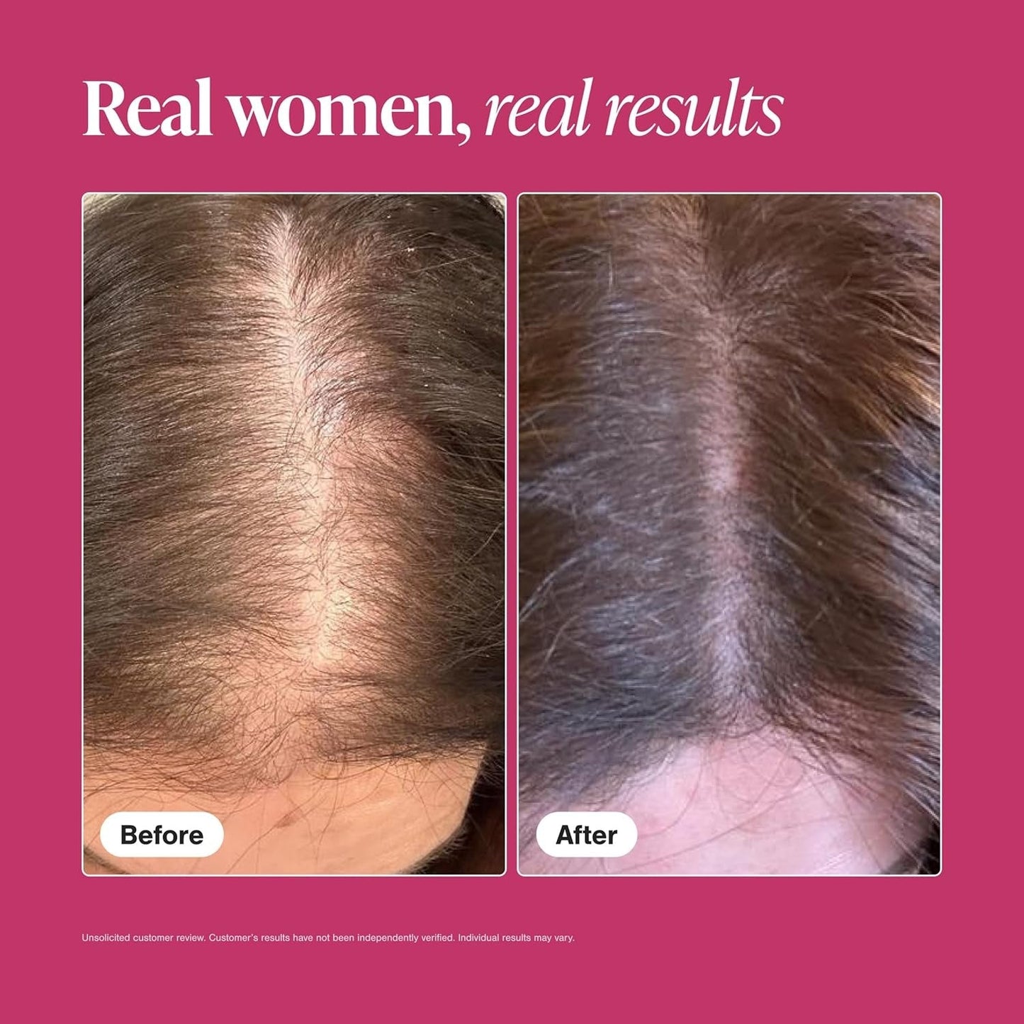 Viviscal Hair Growth Supplement for Women 180 Tablets